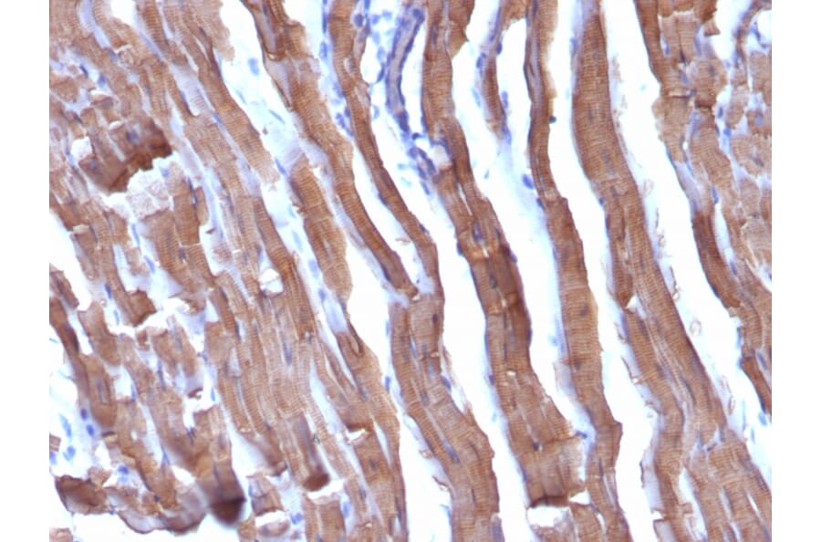 Immunohistochemistry - Anti-Muscle Actin Antibody [HHF35 + MSA/953] (A250948) - Antibodies.com