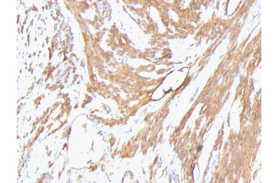 Immunohistochemistry - Anti-Muscle Actin Antibody [HHF35 + MSA/953] (A250947) - Antibodies.com
