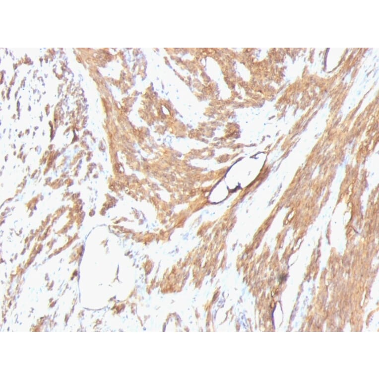 Immunohistochemistry - Anti-Muscle Actin Antibody [HHF35 + MSA/953] (A250947) - Antibodies.com