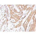 Immunohistochemistry - Anti-Muscle Actin Antibody [HHF35 + MSA/953] (A250947) - Antibodies.com