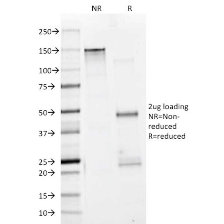 SDS-PAGE - Anti-Muscle Actin Antibody [HHF35 + MSA/953] (A250948) - Antibodies.com