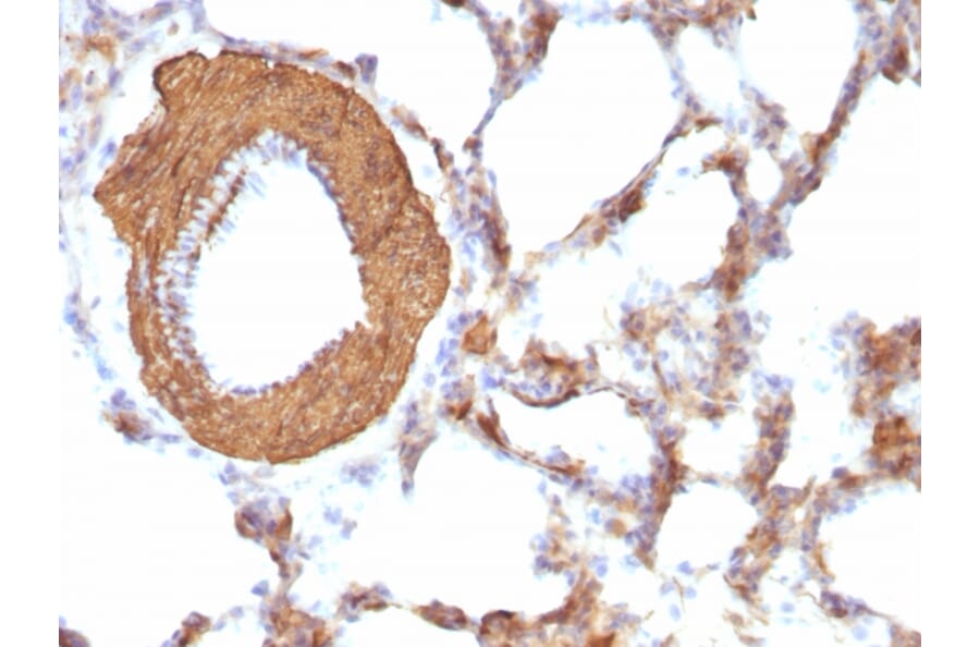 Immunohistochemistry - Anti-Muscle Actin Antibody [HHF35 + MSA/953] (A250948) - Antibodies.com