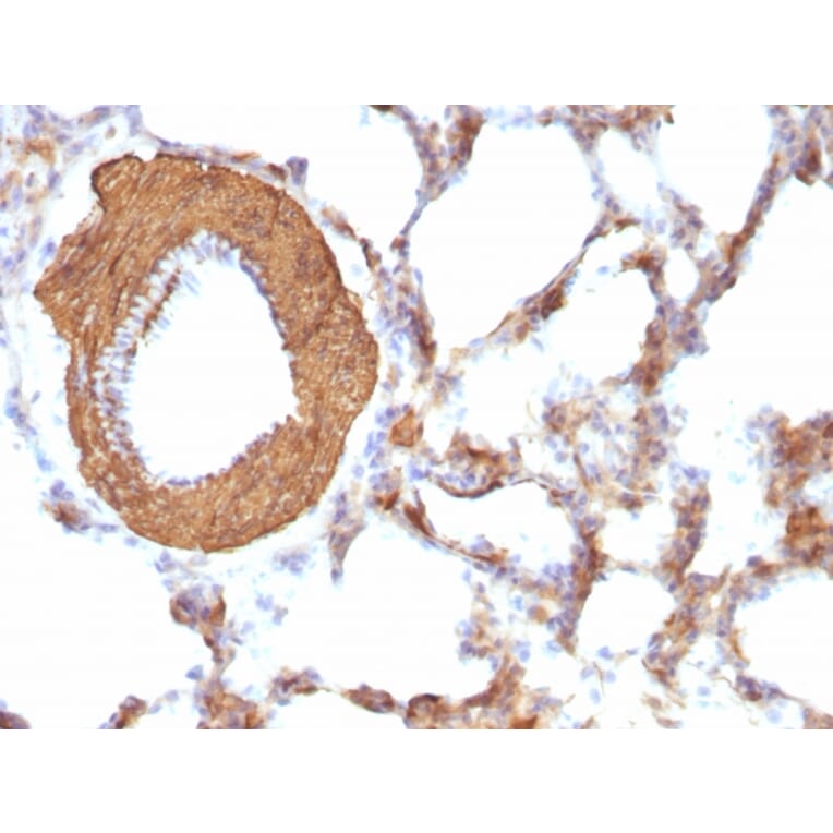 Immunohistochemistry - Anti-Muscle Actin Antibody [HHF35 + MSA/953] (A250948) - Antibodies.com