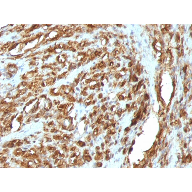 Immunohistochemistry - Anti-Muscle Actin Antibody [HHF35 + MSA/953] (A250948) - Antibodies.com