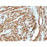 Immunohistochemistry - Anti-Muscle Actin Antibody [HHF35 + MSA/953] (A250948) - Antibodies.com