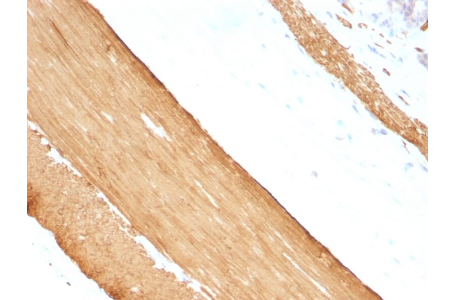 Immunohistochemistry - Anti-Muscle Actin Antibody [HHF35 + MSA/953] (A250948) - Antibodies.com