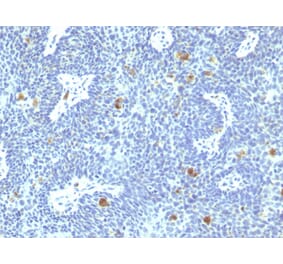 Immunohistochemistry - Anti-HPV16 E6 Antibody [HPV16/1295] (A250948) - Antibodies.com