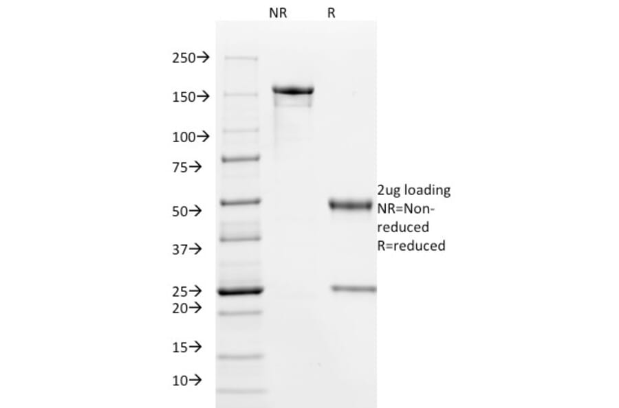 SDS-PAGE - Anti-HPV16 E6 Antibody [HPV16/1295] (A250950) - Antibodies.com