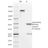 SDS-PAGE - Anti-HPV16 E6 Antibody [HPV16/1295] (A250950) - Antibodies.com
