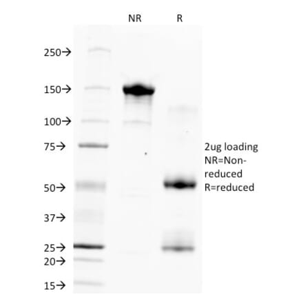 SDS-PAGE - Anti-Hepatocyte Specific Antigen Antibody [HSA133] (A250950) - Antibodies.com