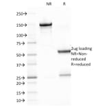 SDS-PAGE - Anti-EBV LMP-1 Antibody [CS2] (A250952) - Antibodies.com