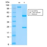 SDS-PAGE - Anti-Keratin 76 Antibody [rKRTH/2148] (A254198) - Antibodies.com