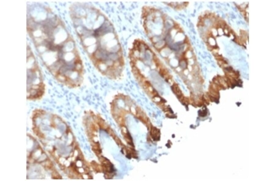 Immunohistochemistry - Anti-Cytokeratin 8 + 18 Antibody [rKRT8.18/1346] (A250955) - Antibodies.com