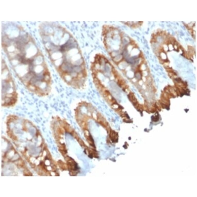 Immunohistochemistry - Anti-Cytokeratin 8 + 18 Antibody [rKRT8.18/1346] (A250955) - Antibodies.com
