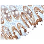 Immunohistochemistry - Anti-Cytokeratin 8 + 18 Antibody [rKRT8.18/1346] (A250955) - Antibodies.com