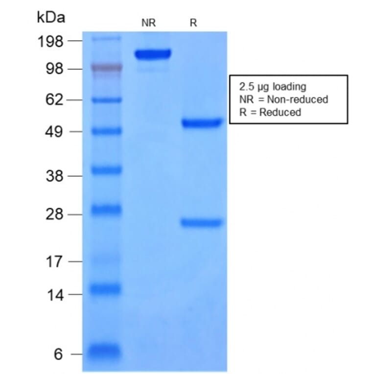 SDS-PAGE - Anti-Cytokeratin 8 + 18 Antibody [rKRT8.18/1346] (A250956) - Antibodies.com