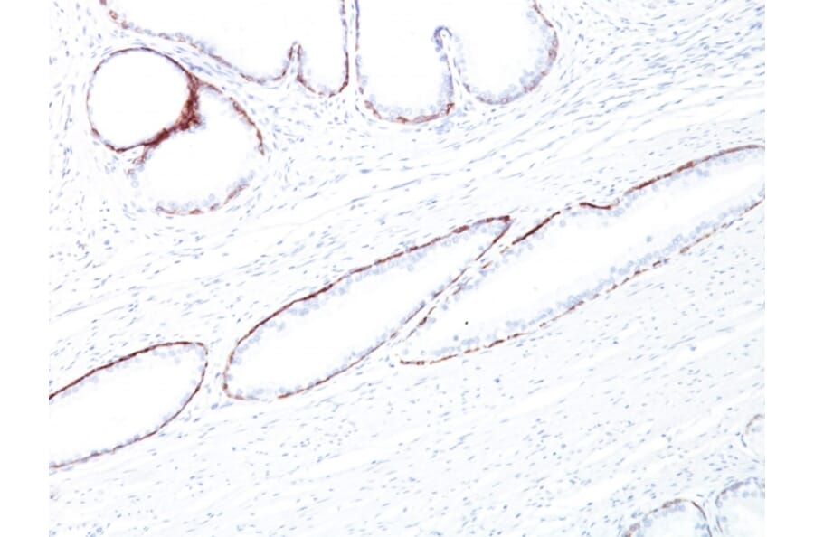 Immunohistochemistry - Anti-Keratin 76 Antibody [34BE12] (A250957) - Antibodies.com