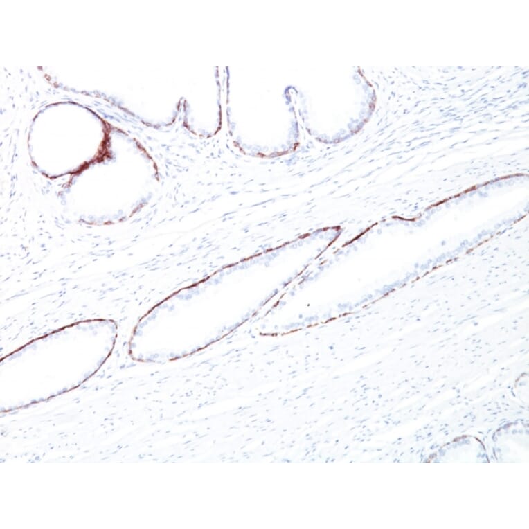 Immunohistochemistry - Anti-Keratin 76 Antibody [34BE12] (A250957) - Antibodies.com