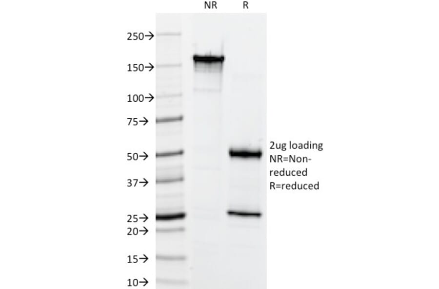 SDS-PAGE - Anti-Keratin 76 Antibody [34BE12] (A250957) - Antibodies.com