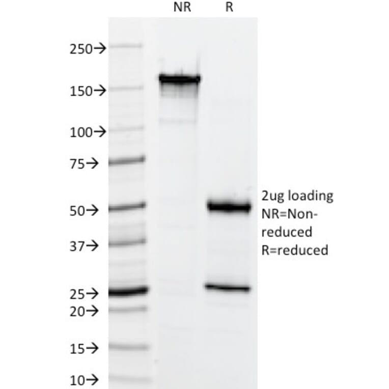 SDS-PAGE - Anti-Keratin 76 Antibody [34BE12] (A250957) - Antibodies.com