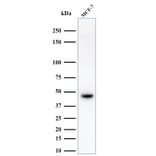 Western Blot - Anti-Keratin 76 Antibody [34BE12] (A250957) - Antibodies.com