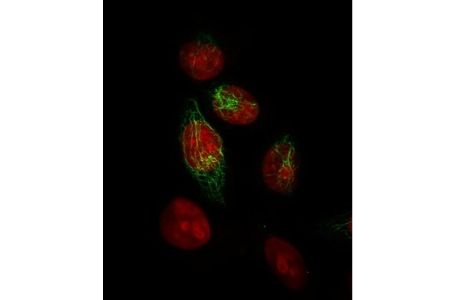 Immunofluorescence - Anti-Keratin 76 Antibody [34BE12] (A250956) - Antibodies.com