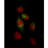 Immunofluorescence - Anti-Keratin 76 Antibody [34BE12] (A250956) - Antibodies.com