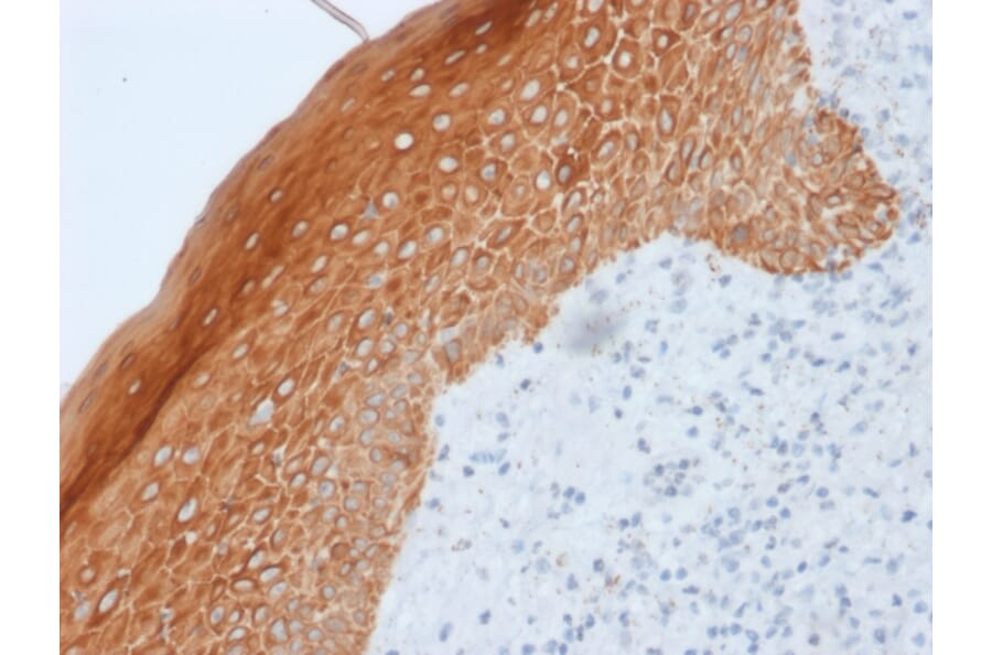 Immunohistochemistry - Anti-Cytokeratin 5 + 6 + 18 Antibody [LP34] (A250958) - Antibodies.com