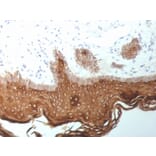 Immunohistochemistry - Anti-Cytokeratin 5 + 6 + 18 Antibody [SPM267] (A250959) - Antibodies.com
