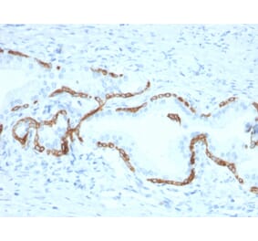 Immunohistochemistry - Anti-Cytokeratin 5 + 6 Antibody [KRT5.6/2438] (A250963) - Antibodies.com