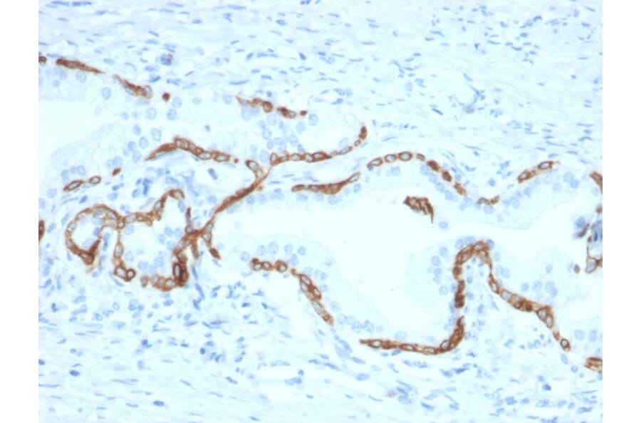 Immunohistochemistry - Anti-Cytokeratin 5 + 6 Antibody [KRT5.6/2438] (A250963) - Antibodies.com