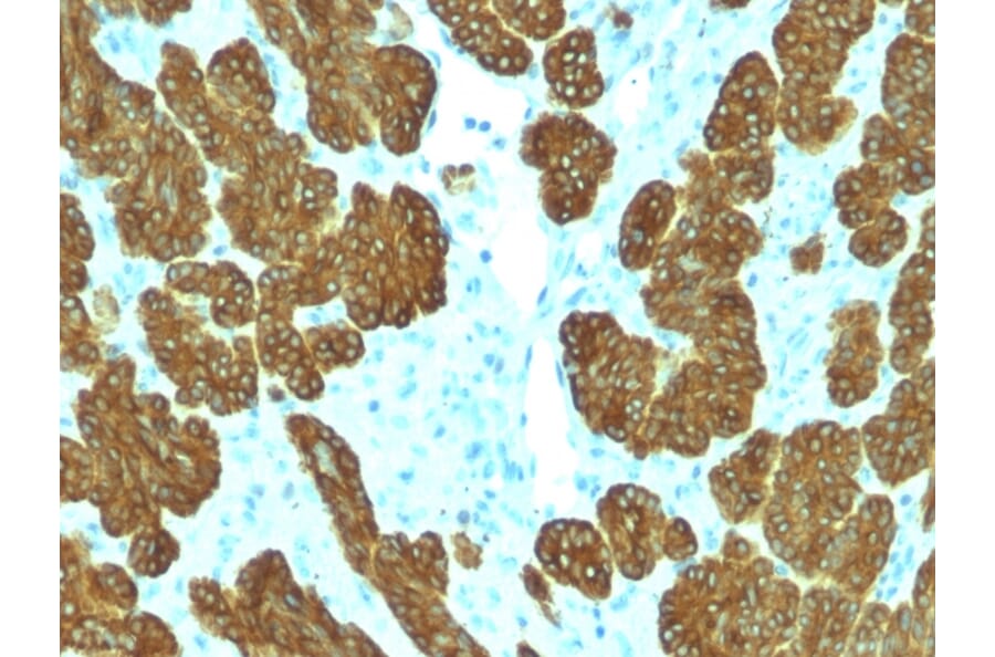 Immunohistochemistry - Anti-Cytokeratin 5 + 6 Antibody [KRT5.6/2438] (A250963) - Antibodies.com