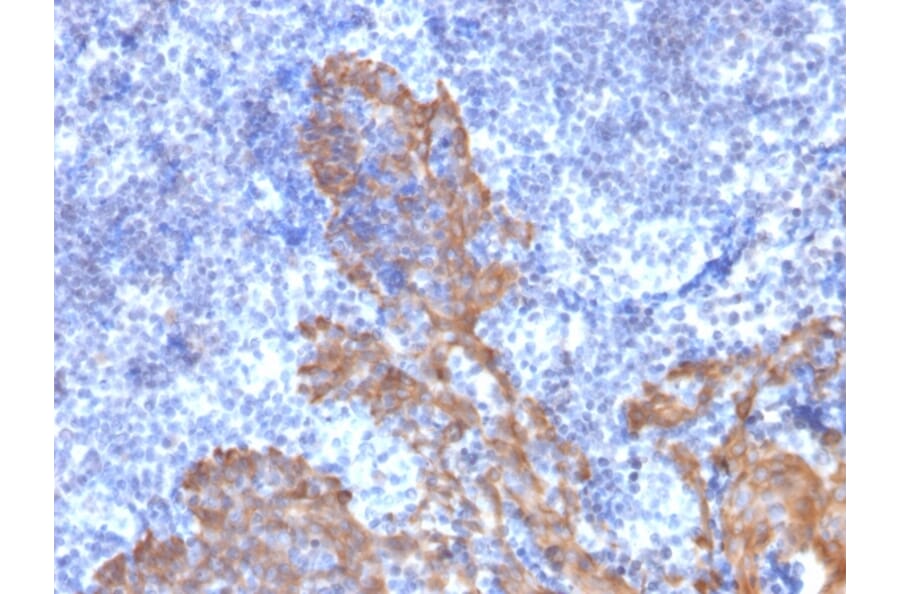 Immunohistochemistry - Anti-Cytokeratin 5 + 6 Antibody [KRT5.6/2438] (A250963) - Antibodies.com