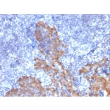 Immunohistochemistry - Anti-Cytokeratin 5 + 6 Antibody [KRT5.6/2438] (A250963) - Antibodies.com