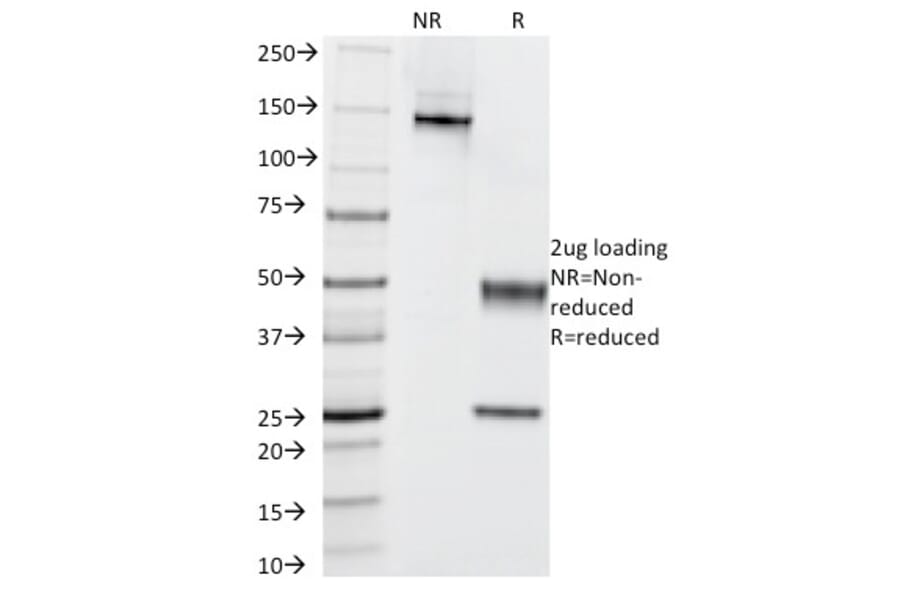 SDS-PAGE - Anti-Cytokeratin 5 + 6 Antibody [KRT5.6/2438] (A250963) - Antibodies.com