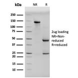 SDS-PAGE - Anti-pan Cytokeratin Antibody [PCK/3150] (A250964) - Antibodies.com