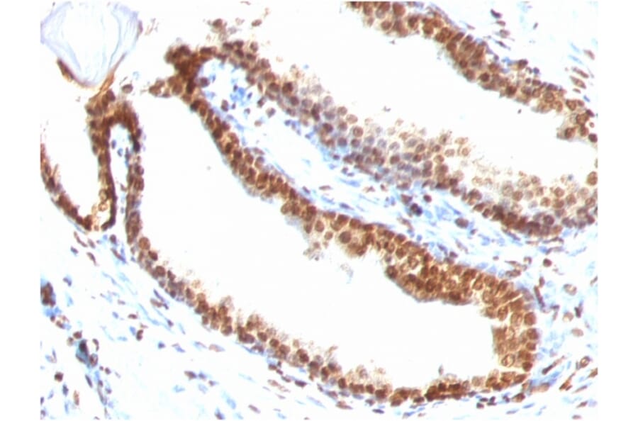 Immunohistochemistry - Anti-ds DNA Antibody [DSD/958] (A250964) - Antibodies.com