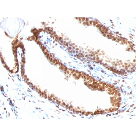 Immunohistochemistry - Anti-ds DNA Antibody [DSD/958] (A250964) - Antibodies.com