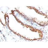 Immunohistochemistry - Anti-ds DNA Antibody [DSD/958] (A250964) - Antibodies.com