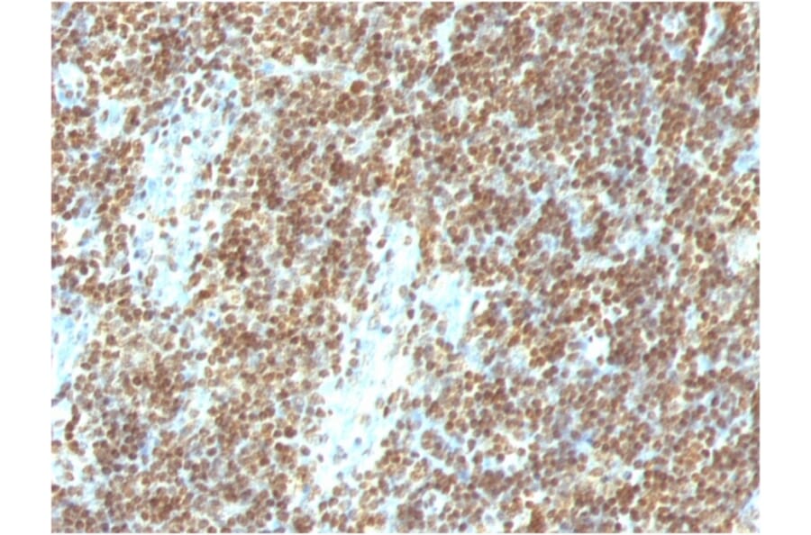 Immunohistochemistry - Anti-ds DNA Antibody [DSD/958] (A250965) - Antibodies.com