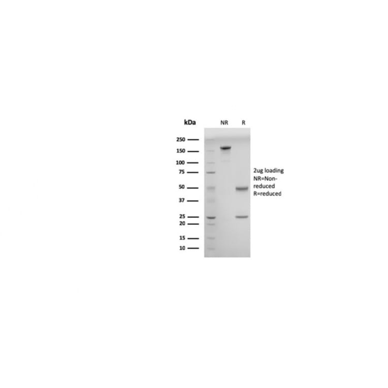 SDS-PAGE - Anti-ds DNA Antibody [DSD/958] (A250965) - Antibodies.com