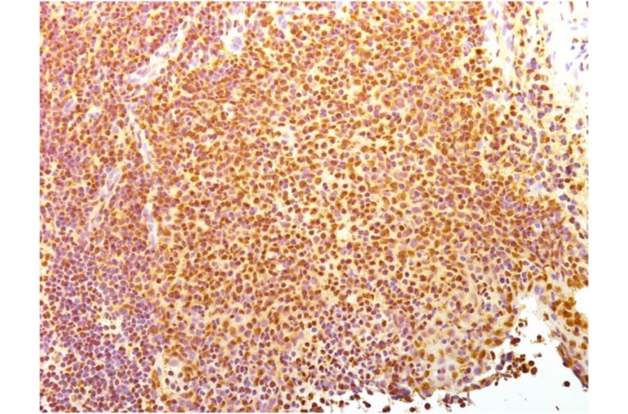 Immunohistochemistry - Anti-Human Nuclear Antigen Antibody [235-1] (A250966) - Antibodies.com