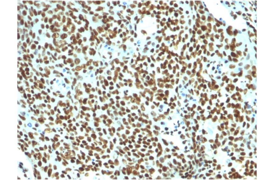 Immunohistochemistry - Anti-Nuclear Antigen Antibody [NM106] (A250968) - Antibodies.com