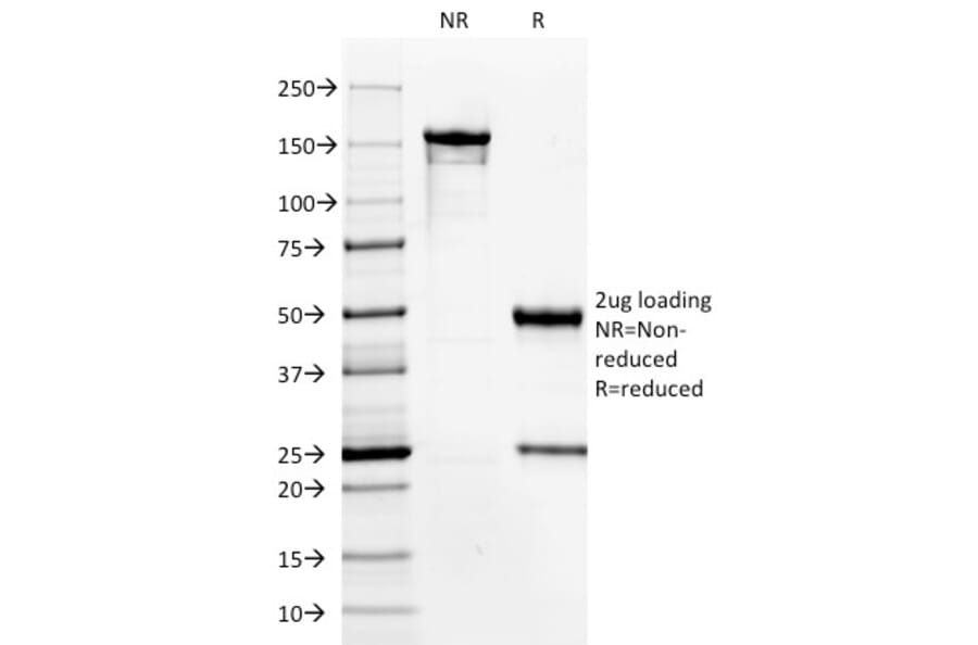 SDS-PAGE - Anti-HPV16 Antibody [HPV16/1296] (A250969) - Antibodies.com