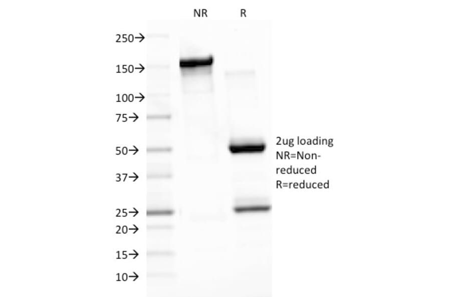 SDS-PAGE - Anti-EBV LMP-1 Antibody [CS3] (A250969) - Antibodies.com