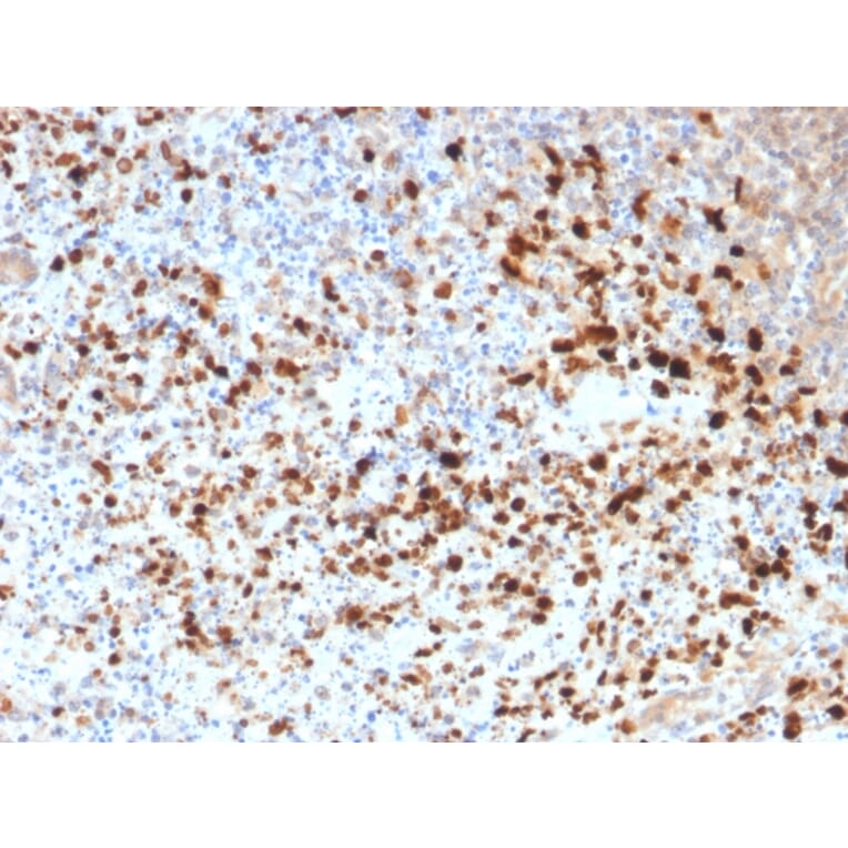 Immunohistochemistry - Anti-HSV1 Antibody [HSV1/1934] (A250970) - Antibodies.com