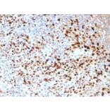 Immunohistochemistry - Anti-HSV1 Antibody [HSV1/1934] (A250970) - Antibodies.com