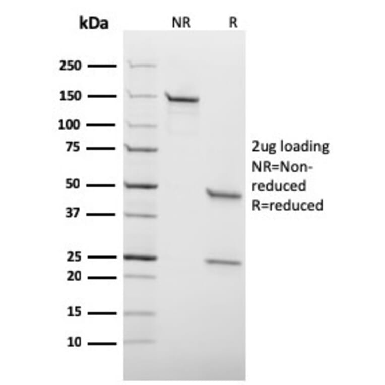 SDS-PAGE - Anti-HSV1 Antibody [HSV1/1934] (A250971) - Antibodies.com