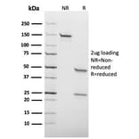 SDS-PAGE - Anti-HSV1 Antibody [HSV1/1934] (A250971) - Antibodies.com