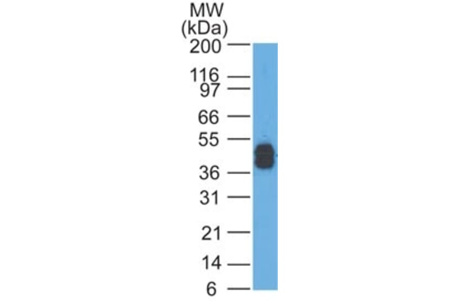Western Blot - Anti-Keratin 77 Antibody [AE-1] (A250972) - Antibodies.com